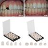 1 Box for Anterior Teeth 1 Box for Molar Dental Temporary Crown Material(140Pcs) view 3