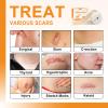 Carbou Silicone Scar Sheets (1.6"x 60"Roll) Medical Silicone Scar Tape Roll,Easy-Tear Soft Silicone Tape for Scars Removal,Reusable Painless Silicone Sheets for Surgery Scars, C-Section, Burn, Keloid view 2