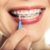 40 Counts Interdental Brush Toothpick Dental Tooth Flossing Head Oral Dental Brush Flosser Mini Tooth Cleaning Tool with Storage Box for Cleaner Braces Oral Cleaning, Red, Blue, Green, Orange view 4