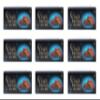 Dark Fantasy Choco Meltz 75g (Pack of 9)  Crisp Choco Cookie in the Centre - Triple-Layer Chocolatey Delight  Chocolate Coating on Outside view 1
