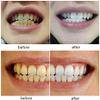 2 Pairs Veneers Snap in Teeth, Snap on Veneer Teeth, Fake Teeth, Instant Veneers Dentures Fake Snap on Teeth Smile Men And Women(Top And Bottom) view 4