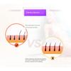1Pcs Electric Lady Shaver, Portable IPX4 Waterproof Purple Facial Hair Removal, Painless Hair Remover Shaver for Ladies, Women's Electric Shaver Razor for Body, Face, Leg, Bikini Line view 3