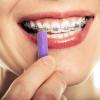20 Pieces Aligner Tray Seaters for Aligner Trays Chompers Aligner Trays (Purple) view 3