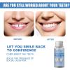 PAKEY Temporary Tooth Repair Kit, Temporary Tooth Filling, Non-Toxic Materials, Tooth Gel Filling for Film TV Cosmetics, Tooth Repair Kit for Filling, Fixing, Missing and Broken Tooth view 3