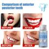 PAKEY Temporary Tooth Repair Kit, Temporary Tooth Filling, Non-Toxic Materials, Tooth Gel Filling for Film TV Cosmetics, Tooth Repair Kit for Filling, Fixing, Missing and Broken Tooth view 4