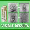 6PCS Haemorrhheal Herbal Cream, Chinese Herbal Hemorrhoids Cream, Painless Hemorrhoid Relief Cream, Anal Cream, Maximum Strength Pain Relief view 3