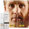 Groomarang Beard Roller for Men GROOMARANG 0.5mm Derma Roller for Beard Growth with 540 Titanium Needles & Beard Growth Spray 60ml - Includes Storage Case & Disinfectant Spray 100ml view 3