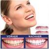 3 Pair False Tooth Replacement Veneers Upper Lower Snap on Cosmetic Teeth Makeover Set for White Beautiful Neat Tooth Dentures view 3