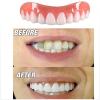 3 Pair False Tooth Replacement Veneers Upper Lower Snap on Cosmetic Teeth Makeover Set for White Beautiful Neat Tooth Dentures view 4