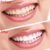 2 Types Safe Reliable Dental Cold Light Smart LED Teeth Whitening Machine Desk Tooth Bleaching Lamp Dental Whitening Instrument with One Goggles,A view 3