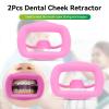 2pcs Mouth Opener, Silicone Dental Cheek Retractor Reusable Oral Cheek Flexible Retracto Dental Mouth Lip Opener for Teeth Whitening, Dental Lip Cheek Retractor Mouthguard - Pink view 2