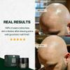 BETTER BE BOLD Nourishing Bald Cream (0-3 mm) | Natural Anti-Shine Effect | Against Skin Irritation and Shaving Burn | Moisturising | Premium Care for Bald Wearers | 50 ml view 4
