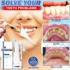 30ml Calculusfree Dissolving Dental Spray, Dental Calculus Remover Teeth Cleaner, Mouth Refreshing Spray, Plaque Remover for Teeth Mouthwash, Intensive Stain Removal Toothpaste (1Pcs) view 3