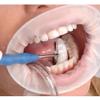 Disposable Lip and Cheek Mouth Opener Latex Oral Rubber Dam for Teeth Whitening Teeth Orthodontic Retractor 10PCS view 4