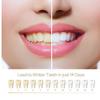 Ayrsjcl 1pcstooth Pen Whitening Bleach Gel Whitener Remove Stains Toothpaste Pen Oral Hygene Dental Care view 3