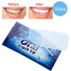 50Pcs Teeth Wipe Cloth Mint Flavor Freshen Mouth Breath Tooth Cleaning Cloth Oral Tooth Deep Cleaning Wipes view 4