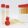 SCDLP 80 BROTH (Soybean Casein Digest Lecithin Polysorbate 80 Medium) - 100 Test Tubes view 1
