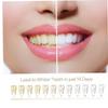 Bemvp Teeth Whitening Pen Tooth Gel Pen Tooth Whitening Gel Whiten Teeth Make You More Confident and Calm view 3