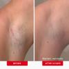 First Aid Beauty Ingrown Hair Pads with BHA & AHA  Daily Treatment Relieves Razor Burn, Prevents Ingrown Hairs and Soothes Irritation  28 Pads view 3