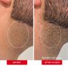 First Aid Beauty Ingrown Hair Pads with BHA & AHA  Daily Treatment Relieves Razor Burn, Prevents Ingrown Hairs and Soothes Irritation  28 Pads view 4