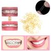 Orthodontic Elastic Rubber Bands and Placers, 500 Pcs Dental Rubber Traction Bands, 5 Pcs Elastic Placer for Braces (3/8",Monkey) view 2