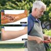 2 Pairs Arm Skin Protection Sleeves Arm Protectors for Thin Skin and Bruising Compression Sleeves Washable Arm Sleeves, Nude, Large view 4