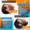 Acusnore MAX Action Anti Snoring Chin Strap  Adjustable, Comfortable Snore Stopper  Natural Snoring Aid for Better Sleep, Jaw Support, Breathable Neoprene, Universal Fit view 3