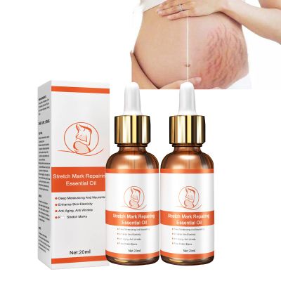 2/3/4PCS Stretch Mark Repair Essential Oil,Stretch Mark Oil for Pregnancy,Pregnancy Oil to Prevent Stretch Marks,Remove Stretch Marks,For Repair Scar Postpartum Essential Oil (2PCS)