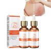 2/3/4PCS Stretch Mark Repair Essential Oil,Stretch Mark Oil for Pregnancy,Pregnancy Oil to Prevent Stretch Marks,Remove Stretch Marks,For Repair Scar Postpartum Essential Oil (2PCS) view 1