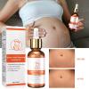 2/3/4PCS Stretch Mark Repair Essential Oil,Stretch Mark Oil for Pregnancy,Pregnancy Oil to Prevent Stretch Marks,Remove Stretch Marks,For Repair Scar Postpartum Essential Oil (2PCS) view 2
