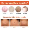 2/3/4PCS Stretch Mark Repair Essential Oil,Stretch Mark Oil for Pregnancy,Pregnancy Oil to Prevent Stretch Marks,Remove Stretch Marks,For Repair Scar Postpartum Essential Oil (2PCS) view 3