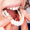 Losuya Instant Veneers Dentures Fake Teeth Smile Teeth Top Fake Teeth for Women and Men view 1