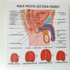 UIGJIOG Prostate Model, 1/2 Cross Cup of Male Human Man Basin Abdominal Cavity Vessie Prostate Health Morbidity Comparison Medical Teaching Explanation Model Doctor-Patient view 3