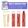 Vein Care Fading Cream, Varicose Vein Cream Leg Swelling Earthworm Leg Care Cream, Improve The Blood Circulation, Relieve Pain of Legs (2) view 3
