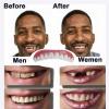 XZLZMD Prosthesis Teeth Reusable Top Bottom Dental Prostheses Cosmetic Natural Color Lnstant Veneers Lnstant repair of Cracked or Missing Dental Prosthesis for Men And Women Unisex,9 pairs view 4