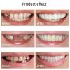 XZLZMD Dentures Silica Top Bottom Dental Prostheses Lnstant repair of Cracked or Missing Dental Prosthesis Cosmetic Natural Color Temporary Prosthesis Teeth Veneer,10 pairs view 4
