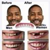 XZLZMD Dentures Cosmetic Veneers Teeth Temporary Dentures Teeth Natural Shade Instant Teeth Top and Bottom Veneers Snap on Comfort Dentures for Bad Teeth Men and Women,4 pair view 4