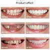 XZLZMD Silica gel Dentures Top Bottom Dental Prostheses Cosmetic Veneer Natural Color Temporary Prosthesis Teeth Lnstant repair of Cracked or Missing Dental Prosthesis for Men And Women,3 pair view 4