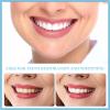 2 Pairs Cosmetic Veneers Teeth Temporary Dentures Fake Teeth Instant Veneer Teeth Top and Bottom Smile Snap on Veneers Comfort False Teeth Braces Whitening Tooth Repair Kit for Men and Women view 2
