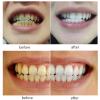 2 Pair Denture Teeth Veneers, Instant Veneer Dentures for Whitening Teaching, DIY Temporary Fake Teeth for Snap on Instant & Confidence Smile view 3