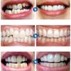 XZLZMD Silica Dentures Lnstant repair of Cracked or Missing Dental Dental Temporary False Teeth Top and Bottom Tooth Cover Alternative Dentures,5 pair view 4