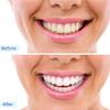 XZLZMD Silica Prosthesis Care Veneers Cosmetic Natural Color Top and Bottom Tooth Dentures Reusable Lnstant repair of Cracked or Missing Dental,2 pair view 4