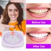 Agatige Dental Polishing Strips, 50um Thickness Tooth File Teeth Abrasive Finishing Strips Tooth Interdental Sanding Grinding Whitening Teeth Surface view 4