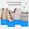 Organic Scar Removing Gel, Scar Removal Cream for Old and New Scars, Advanced Scar Gel for Face Body, Scar Repair Gel Cream for Man and Women view 3