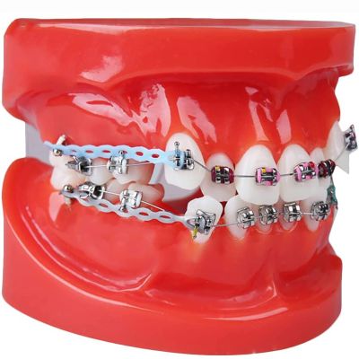PURFWOG Dental Typodont Adult Demonstration Teeth Model with Mental Teeth Orthodontic Braces Model with Ligature Ties Red