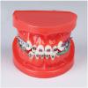 PURFWOG Dental Typodont Adult Demonstration Teeth Model with Mental Teeth Orthodontic Braces Model with Ligature Ties Red view 4