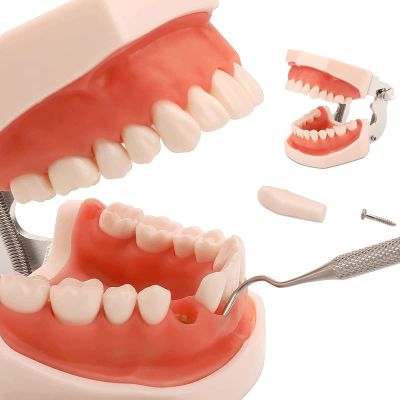 BFEIWGHA Teeth Teaching Model Standard Teeth Model Adult Teeth Model Removable Teeth Model And Soft Gums, 28 Teeth Dental Implant Model For Dental Teaching Or Oral Care