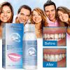 MTDBAOD Tooth Repair Granules Moldable False Teeth Thermal Beads Kit Broken Teeth Adhesives Broken Teeth Filling Gaps Repair DIY Heat Fit Beads Repair Missing Teeth view 3