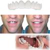 Dental Veneers, Smile Instant Temporary Teeth Kit Decor, Perfect Braces & Whitening Alternative, Smile in Minutes (1 Pair) view 3