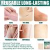 Silicone Scar Sheets, Reusable Scar Removal Strips Scar Removal Patch, Scar Silicone Tape Strips, Fast and Effective Professional Scar Removal Sheets for C-Section, Surgery, Burn, Keloid, Acne view 4
